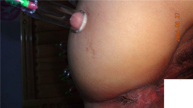 尪是自拍狂老娘拔罐也拍 (18P)